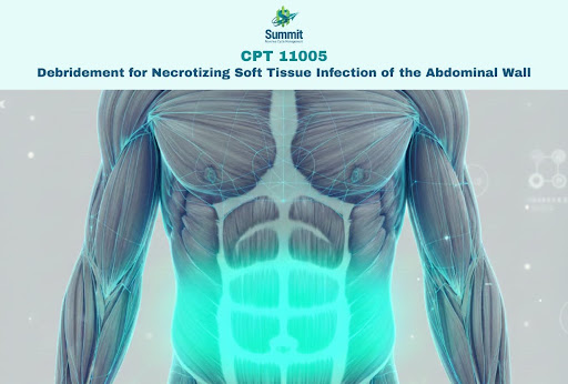 CPT 11005 Coding Guide for Abdominal NSTI Debridement