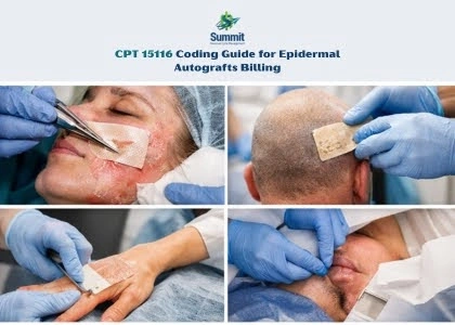 CPT 15050